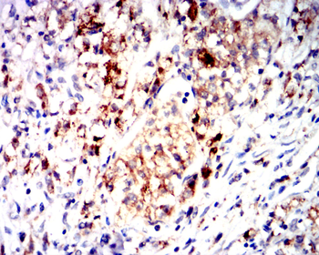 MMP1 Antibody