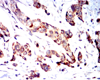 GSTP1 Antibody