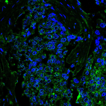 LEP Antibody