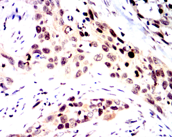 ATF6 Antibody