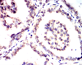 ATF6 Antibody