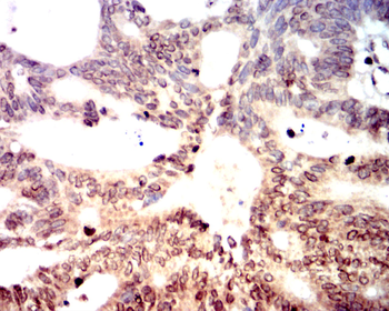 PMS2 Antibody