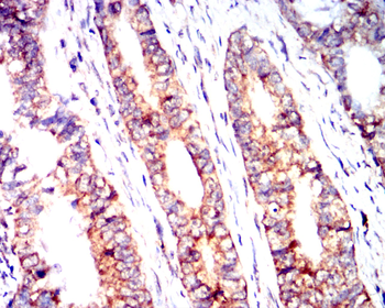PMS2 Antibody