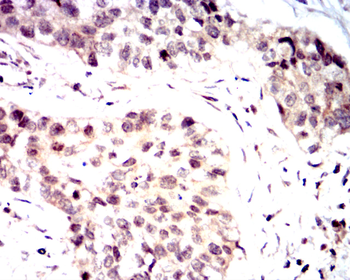 PMS2 Antibody