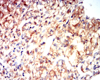 VEGFA Antibody
