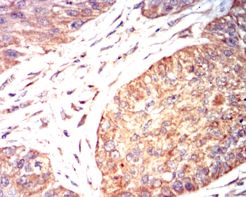 VCAM1 Antibody