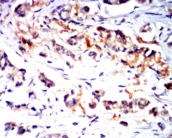 Collagen X Rabbit Polyclonal Antibody