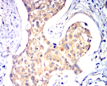 Collagen X Rabbit Polyclonal Antibody