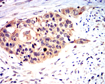 Collagen X Rabbit Polyclonal Antibody