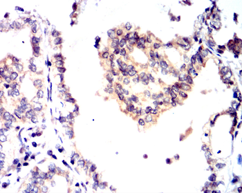 CALB2 Antibody