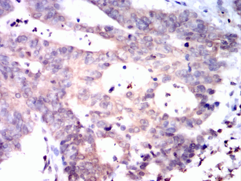 ACACA Antibody