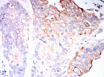 LEPR Antibody