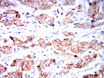 MUC1 Antibody