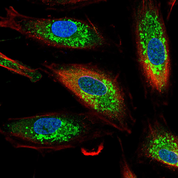 TY3H Rabbit Polyclonal Antibody