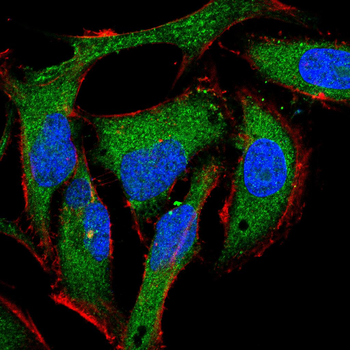 CTSD Antibody