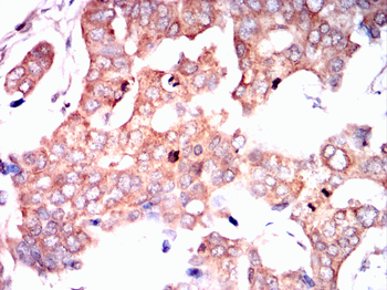 PDCD6IP Antibody