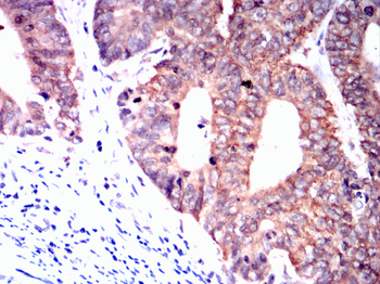 PDCD6IP Antibody