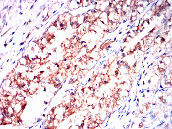 PDCD6IP Antibody