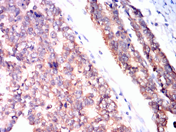 PDCD6IP Antibody