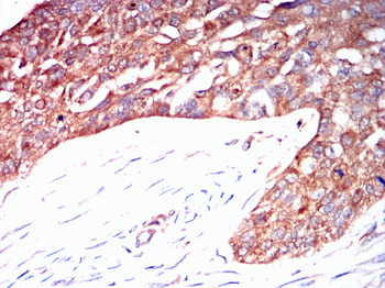 CD38 Antibody