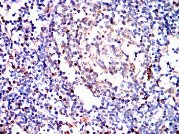 CD38 Antibody