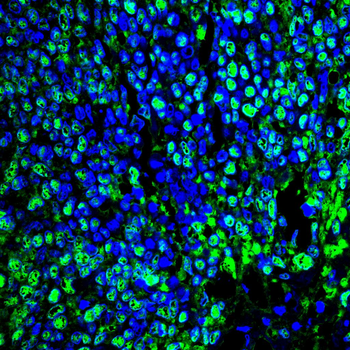 RB1 Antibody