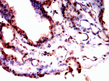 RB1 Antibody