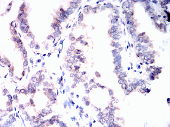 RB1 Antibody