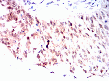 RB1 Antibody