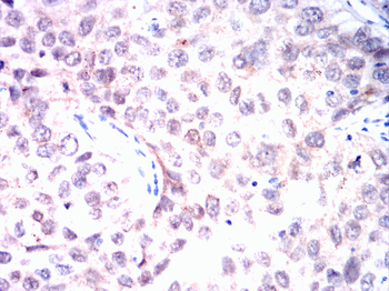 RB1 Antibody