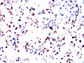 RB1 Antibody
