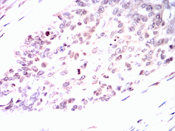 CEBPB Antibody