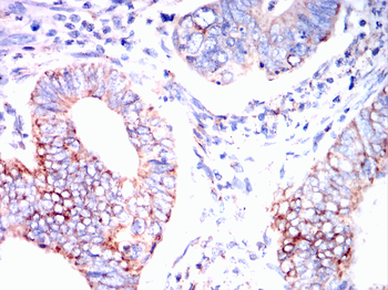 SOD2 Antibody