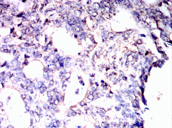 ENO2 Antibody