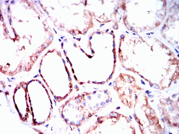 ENO2 Antibody