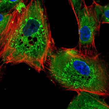 CDK6 Antibody