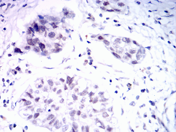 FOXA1 Antibody