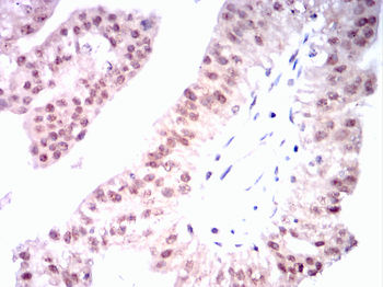 CDK5 Antibody