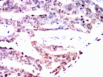 VDR Antibody