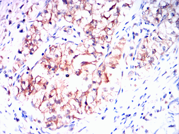 VDR Antibody