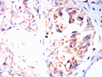 TP53BP1 Antibody