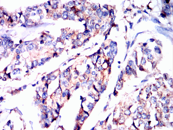 FGF21 Antibody