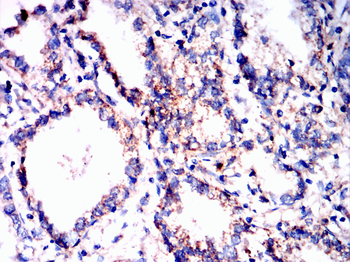 FGF21 Antibody
