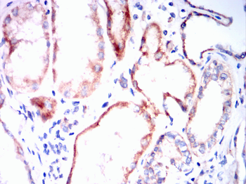 ATG5 Antibody