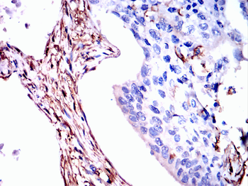 LGALS1 Antibody