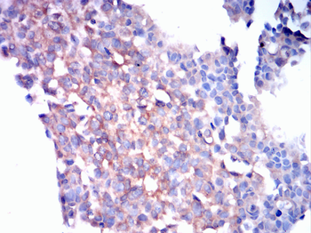 ROCK1 Antibody