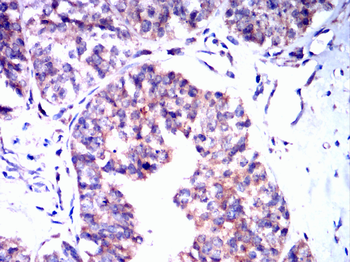 ROCK1 Antibody