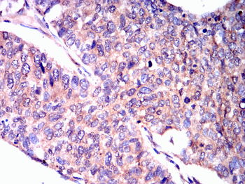 CHUK Antibody
