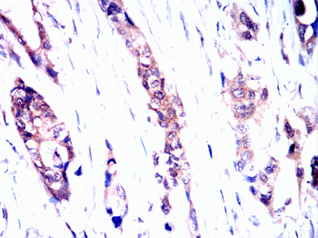 CHUK Antibody