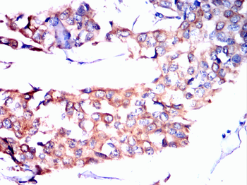 BCL2A1 Antibody